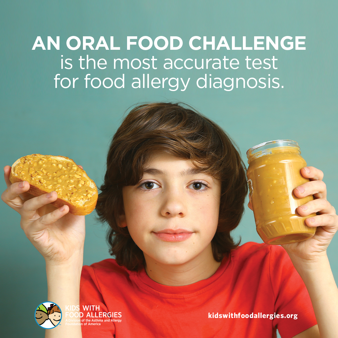 口服食物挑战是食物过敏诊断的最准确测试